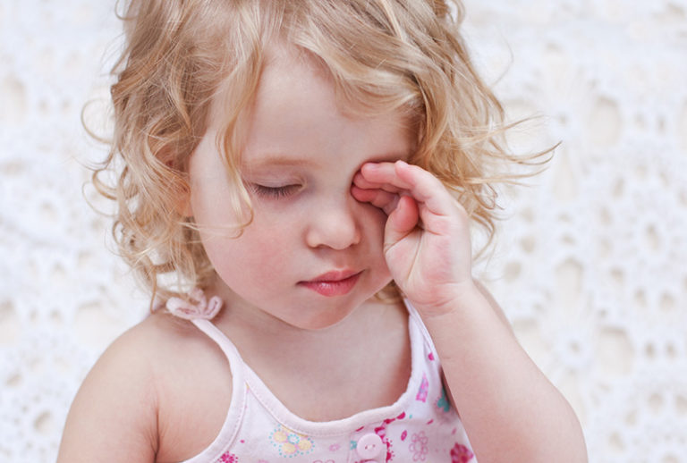 Conjuntivitis alérgica en niños