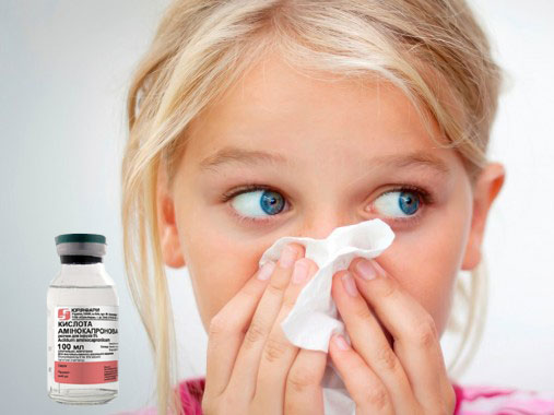 Uso de ácido aminocaproico en niños con resfríos