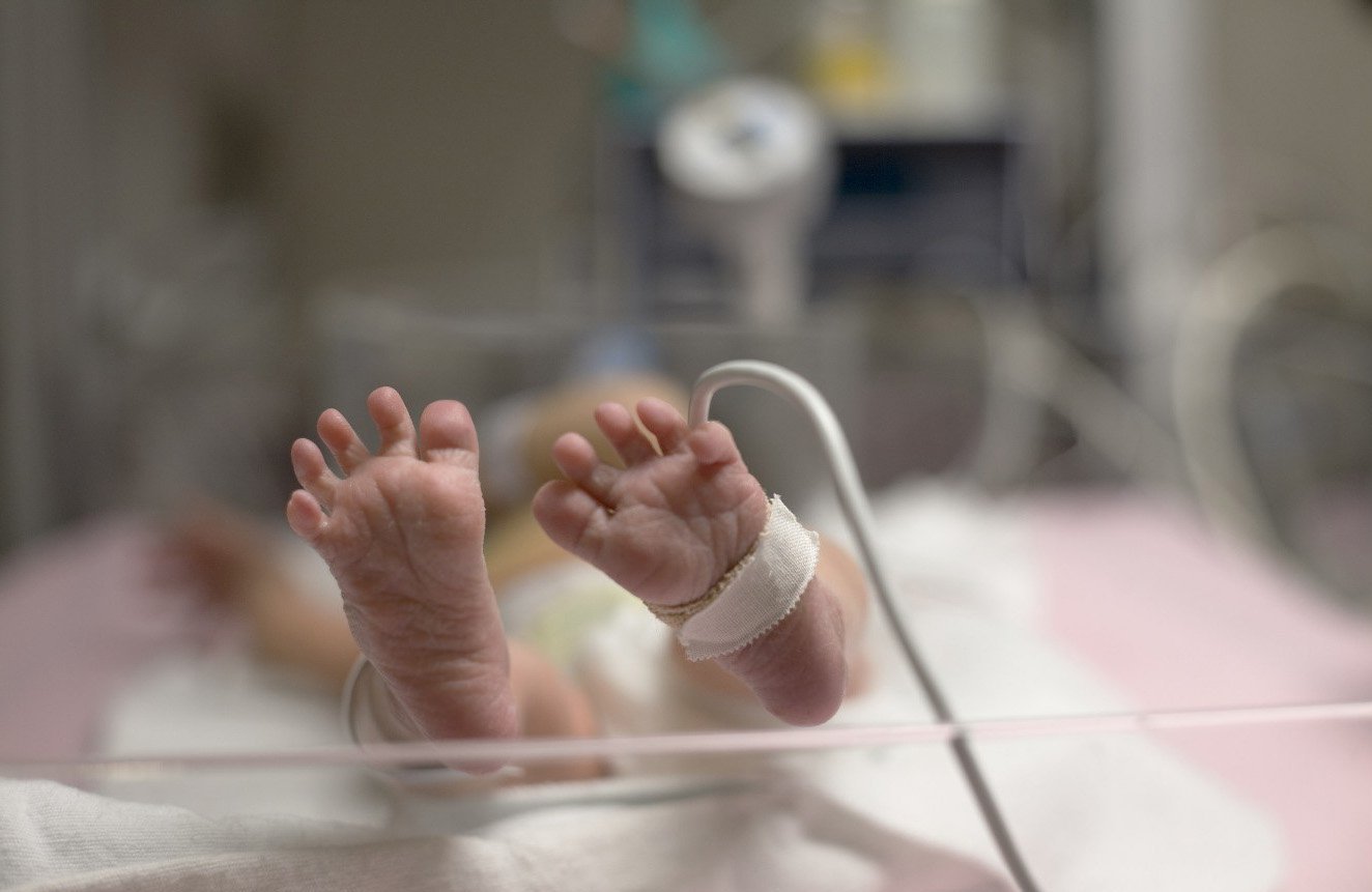 Ayuda para bebés prematuros en Rusia
